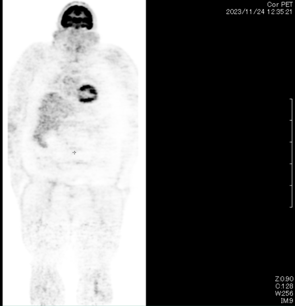 Description of image